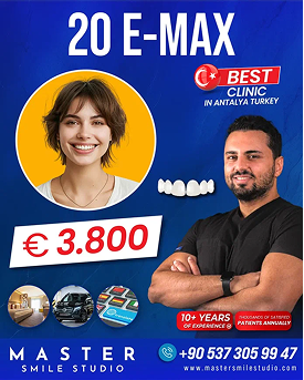 20 E-Max Veneer: Hollywood Gülüş Tasarımı ile Işıltınızı Yansıtın