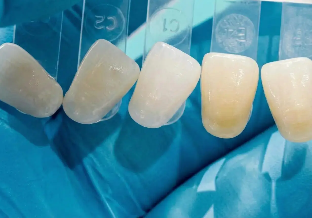 Porselen Diş Kuronları